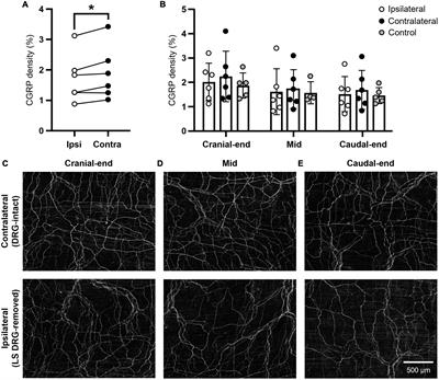 Anatomical distribution of CGRP-containing lumbosacral spinal afferent neurons in the mouse uterine horn